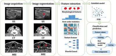 The progress of radiomics in thyroid nodules